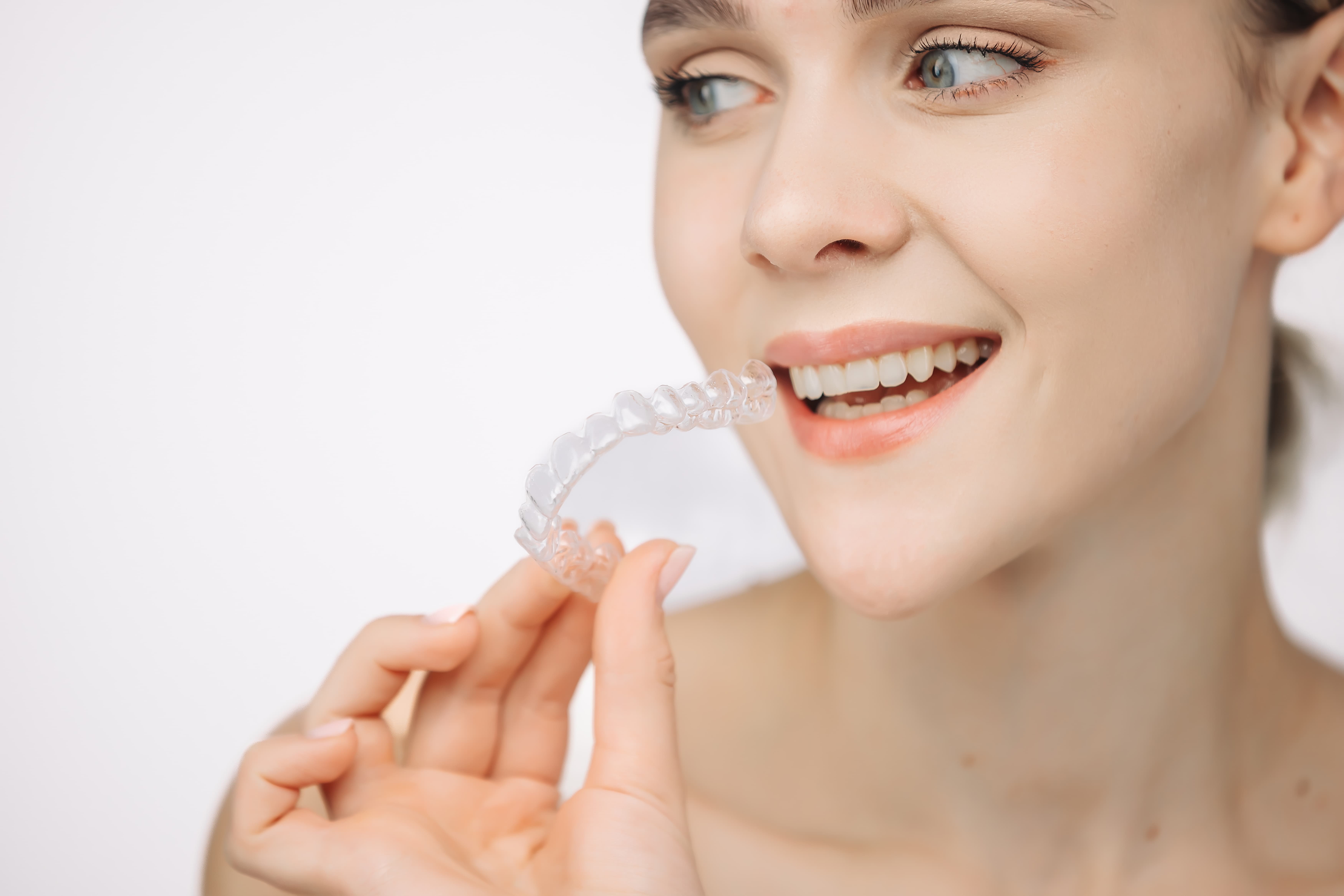 Clínica BS Odontología - Alineadores invisibles